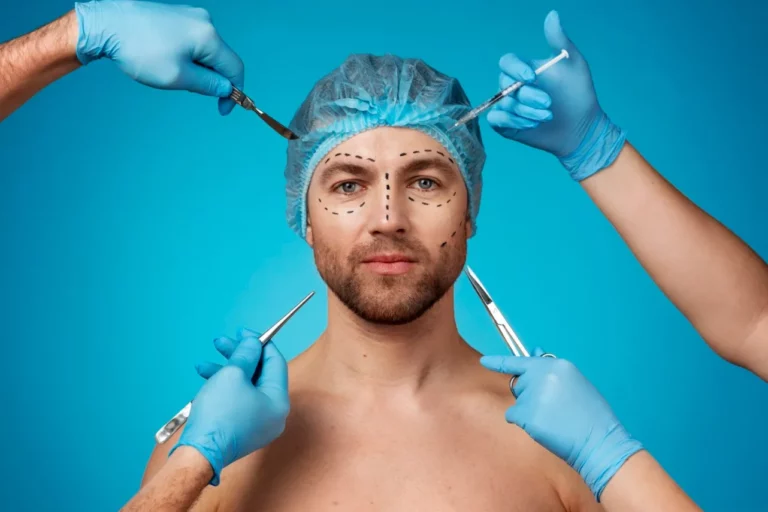 Frozen Faces and High Costs 5 Cosmetic Surgery Myths Debunked